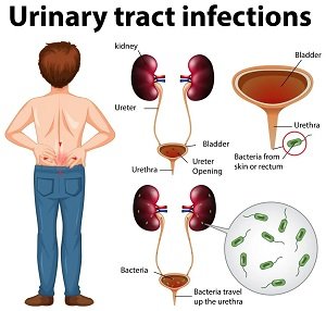 Urinary Problems